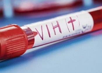 Pide ONU no olvidar la pandemia de Sida durante la actual emergencia sanitaria por COVID