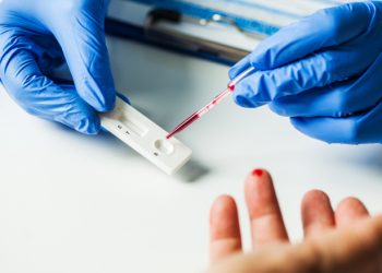 Salud rechaza uso de pruebas sanguíneas para diagnosticar COVID-19