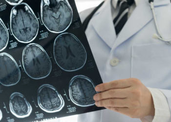 Descubren utilidad de fármacos para la hipertensión para un cáncer cerebral