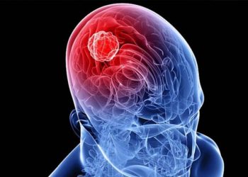 Identifican un gen causante de un nuevo síndrome neurológico y óseo