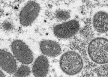 Estados Unidos confirma 12 casos de viruela del mono