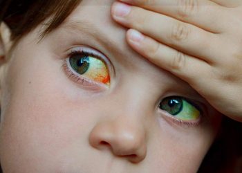 ¿Cuáles son los síntomas de la hepatitis infantil aguda? Nuestro médico de cabecera nos explica