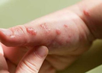 Movimiento Humanismo busca erradicar corrupción en Jalisco