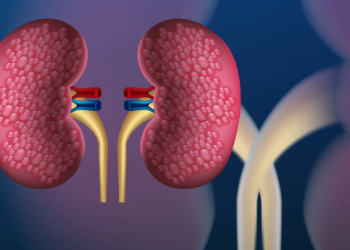 El tabaco explica el 30% de todos los cánceres que existen en el mundo: Dr. Rodríguez