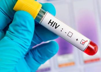 Revelan una nueva vulnerabilidad del VIH que podría ser objeto de fármacos