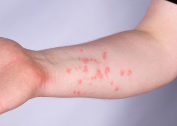 La declaratoria de la OMS es importante ya que alerta a las personas para tomar las medidas pertinentes: García