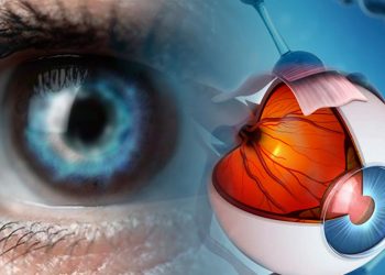 Enfoque al cuidado de la Salud: ¿Qué son las cataratas y cómo tratarlas?