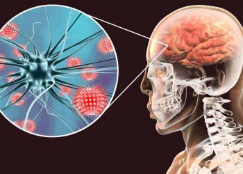INFOGRAFIA: ¿Qué es la Meningitis y por qué es tan peligrosa?