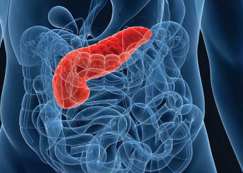 Prueban un páncreas artificial para pacientes con diabetes tipo 2. Te contamos