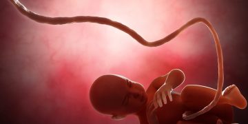 El uso del cordón umbilical en contra del cáncer