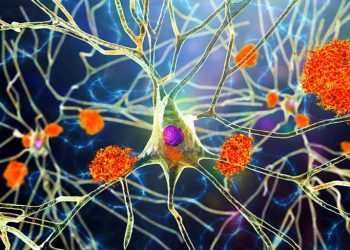 Conoce el prometedor medicamento experimental contra el alzhéimer