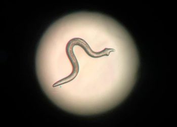 Una molécula puede ser clave en contra de la obesidad