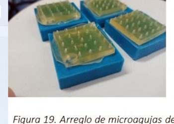 Parche con microagujas facilitaría el tratamiento de quemaduras y úlceras en personas diabéticas