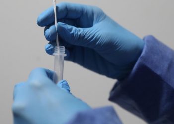 Científicos desarrollan un test que detecta COVID 19 a bajas concentraciones y en 10 minutos