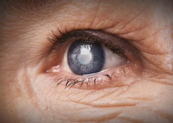 ¿Qué es el glaucoma y puede darle a los jóvenes? Experto nos dice