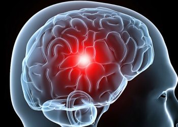 ¿Qué relación tiene la hipertensión y la demencia? Esto dice estudio