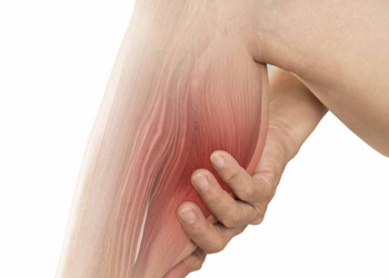 ¿Sufres de calambres más de dos veces a la semana? esto alertan especialistas