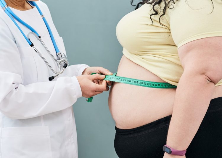 Obesity, unhealthy weight. Nutritionist inspecting a woman's waist using a meter tape to prescribe a weight loss diet