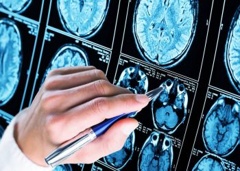 Descubren cómo las proteínas tóxicas se propagan por el cerebro en el Alzheimer