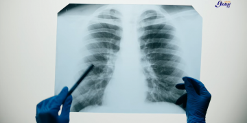 Medicina, la Primera Facultad 100% libre de humo de tabaco