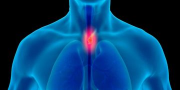 Investigan con radioterapia de protones como posible tratamiento para el cáncer de esófago