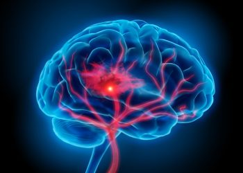 Covid-19 puede infectar las arterias coronarias y aumentar el riesgo de ictus