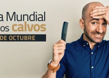 Hoy es el Día Mundial de los Calvos
