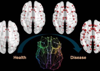 Nuevo método permite ver más al detalle los depósitos de una proteína del alzhéimer