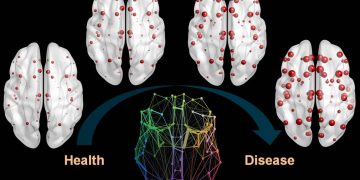 Nuevo método permite ver más al detalle los depósitos de una proteína del alzhéimer