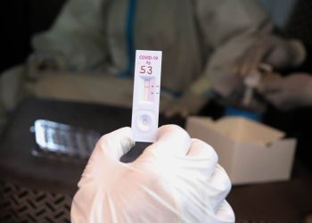 Descarta gobierno capitalino alguna situación grave por casos de COVID 19