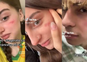 Italia multa a Tik Tok con 10 millones de euros por el reto de “la cicatriz francesa”