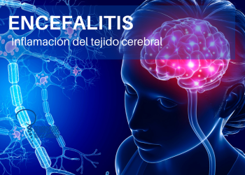 IMSS alerta sobre los síntomas de la encefalitis, para su oportuna atención