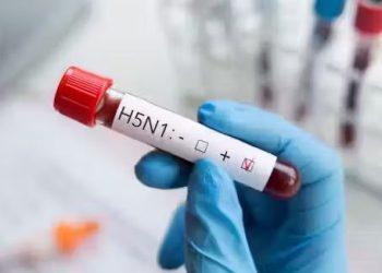 Detectan caso de gripe aviar en una persona en Estados Unidos