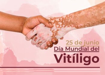 Día Mundial del Vitíligo