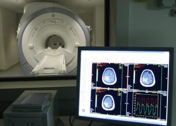 Día mundial del Alzheimer: estos factores lo detonan