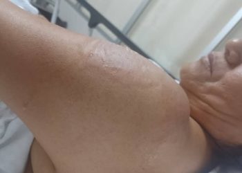 VIDEO: Mujer avienta recipiente con aceite hirviendo a  vendedora de antojitos