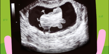 Famosa anuncia embarazo y el mundo reacciona