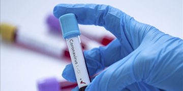 A 5 años del primer caso de Covid-19 en México