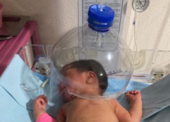 Cesan a directivos del hospital de Macuspana por campana cefálica improvisada