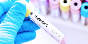 México trabaja para eliminar la hepatitis C en el 2030