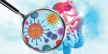 Quienes padecen trastornos intestinales tienen el doble de probabilidad de tener alzhéimer