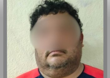Justicia para “Tobi”: Hombre es vinculado a proceso por maltrato animal