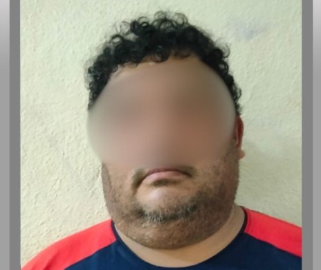 Justicia para "Tobi": Hombre es vinculado a proceso por maltrato animal