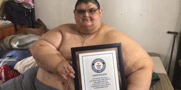 Fallece Juan Pedro Franco, el hombre que fue Récord Guinness por obesidad extrema, en Aguascalientes