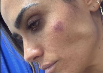 Hay 20 lesionados y 11 denuncias por agresión a Rojo de la Vega