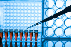Tecnología con datos genéticos para prevención de lesiones