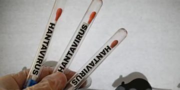Alerta internacional sanitaria por hantavirus, checa aquí la cronología de casos