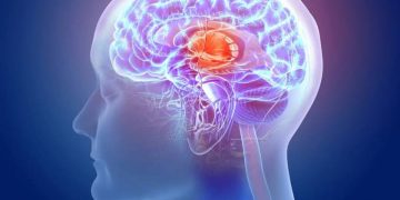 Hallan posible falla en el sistema de limpieza del cerebro relacionada con alzhéimer y ELA